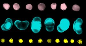 Pollen types captured via microscope