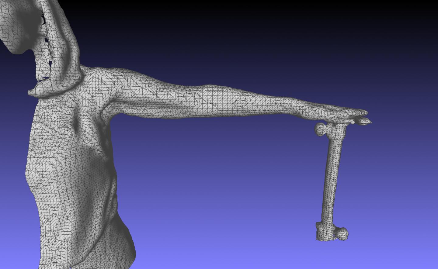 Lymphedema App Makes Point Cloud