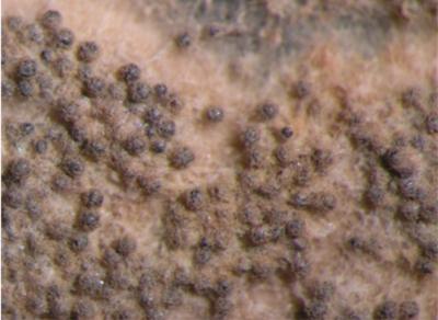 Fungal Sexual Structures