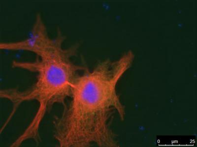 PLK1 Overexpression Pervents Cell Division Thereby Impairing Cell Proliferation and Tumor Growth