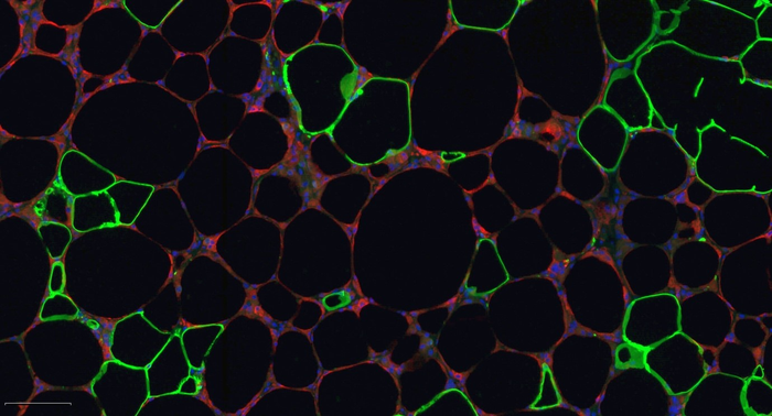 Microscopy image showing white adipose tissue from mice fed a high fat diet