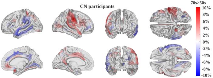 Saliency Map Comparing MRI Scans of Cognitively Normal Adults in their 50s and in their 70s