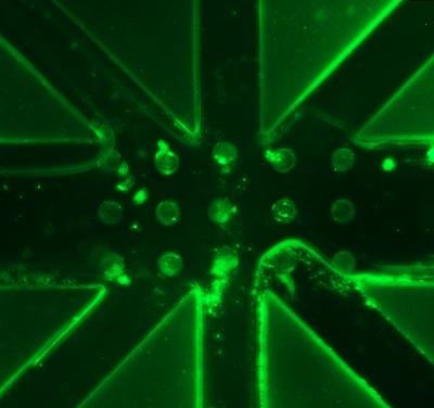 Microfluidic Devive for Live Electrolyte Monitoring in Dialysis