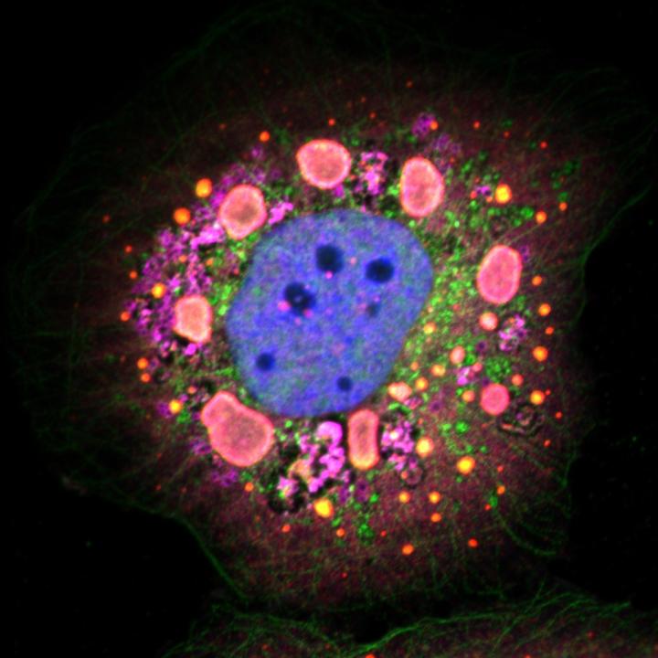 Reovirus-infected Epithelial Cell