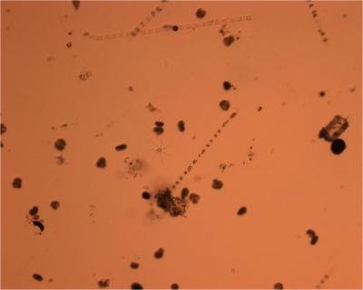 Red Tide and Skeletonema costatum