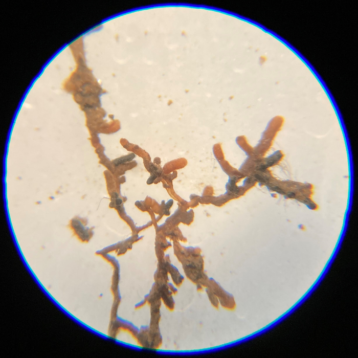 Beech tree roots with mycorrhizal fungi