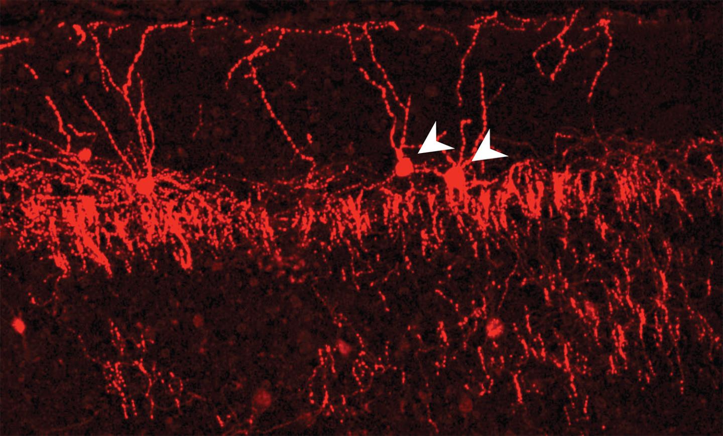 Chandelier Cells Selectively Engaging with Local Neurons