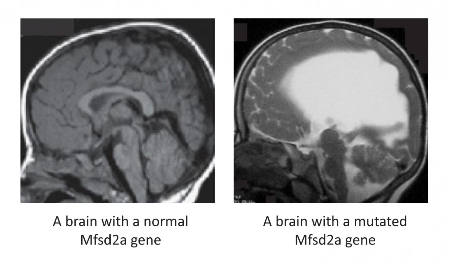 Special Fats Proven Essential for Brain Growth