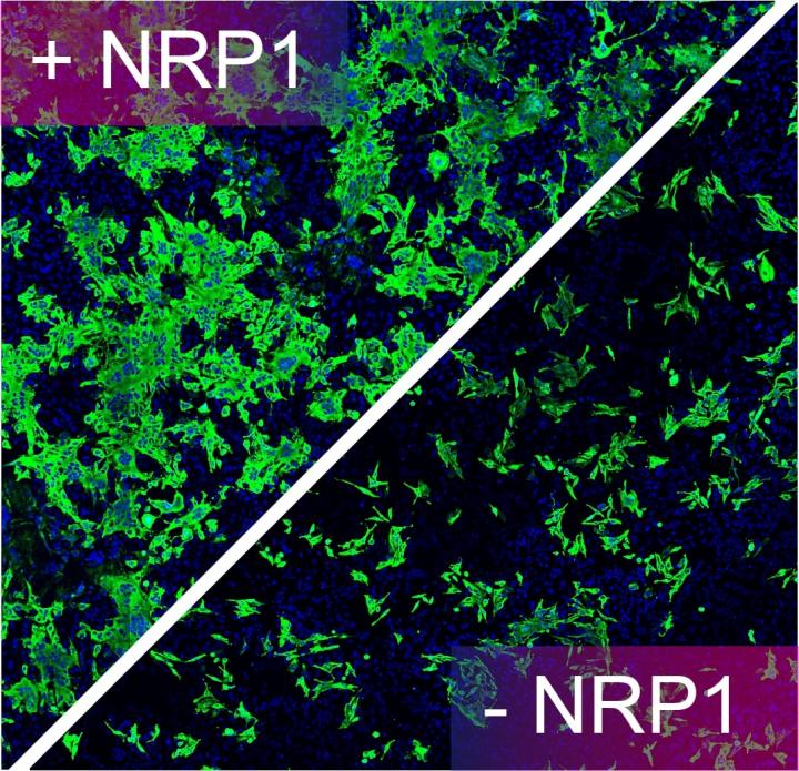 Neuropilin-1 (NRP1) is a host factor for SARS-CoV-2 infection