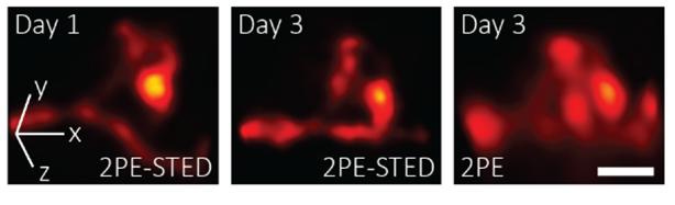 Imaging dendritic spines
