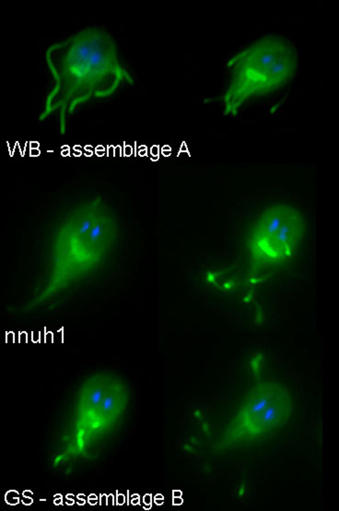 Giardia under the Microscope [IMAGE] EurekAlert! Science News Releases