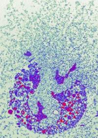 Neutrophil Granulocyte Death