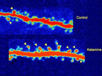 Brain Cells, Rewired