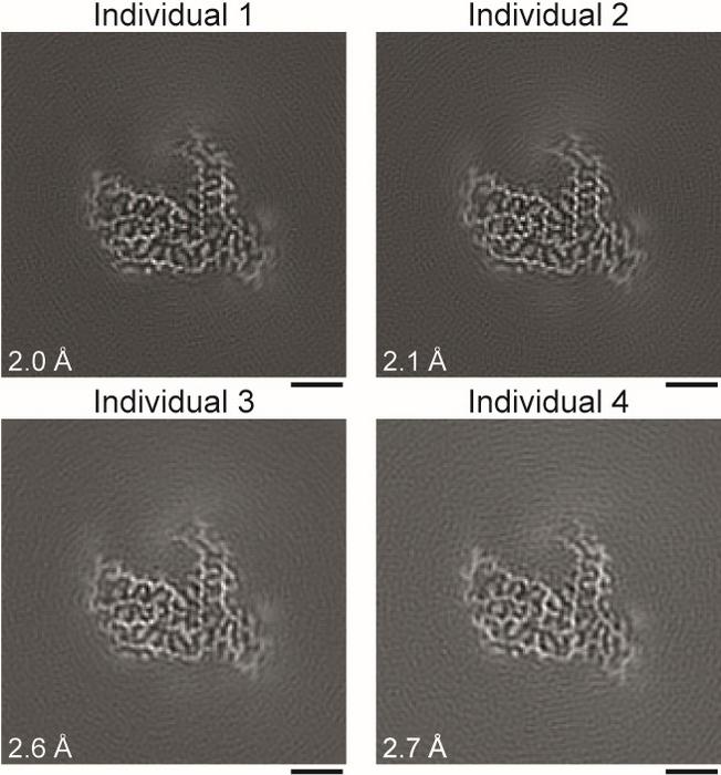 Amyloid filament structures