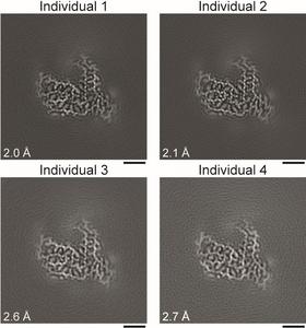 Amyloid filament structures