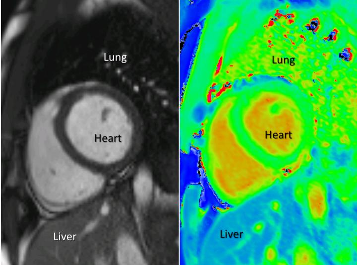 T1-Mapping Compared to Current MRI (Labelled)