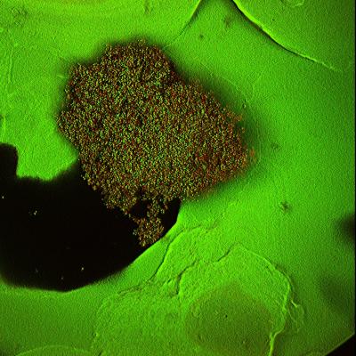 Crabby Compound Could Prevent Biofilm Formation