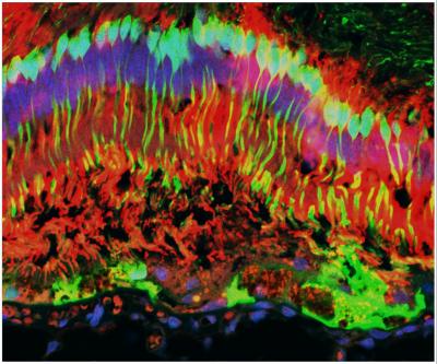 Gene Therapy to Treat Blindness: Finding the Right Dose (3 of 4)