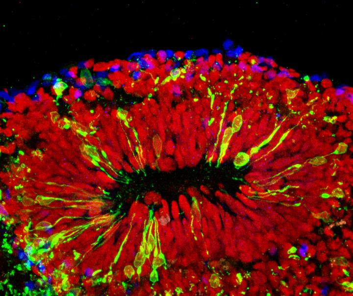 Brain Organoid Infected with Zika Virus