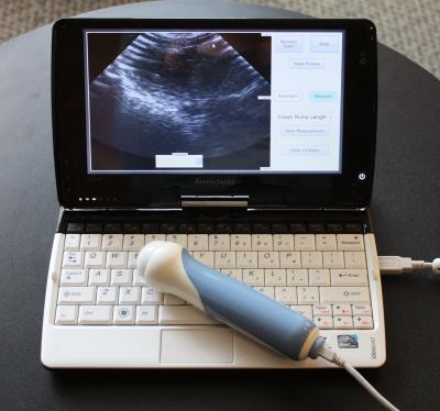 Netbook Ultrasound