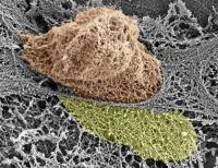 T Cell Squeezes Through Blood Vessel Wall