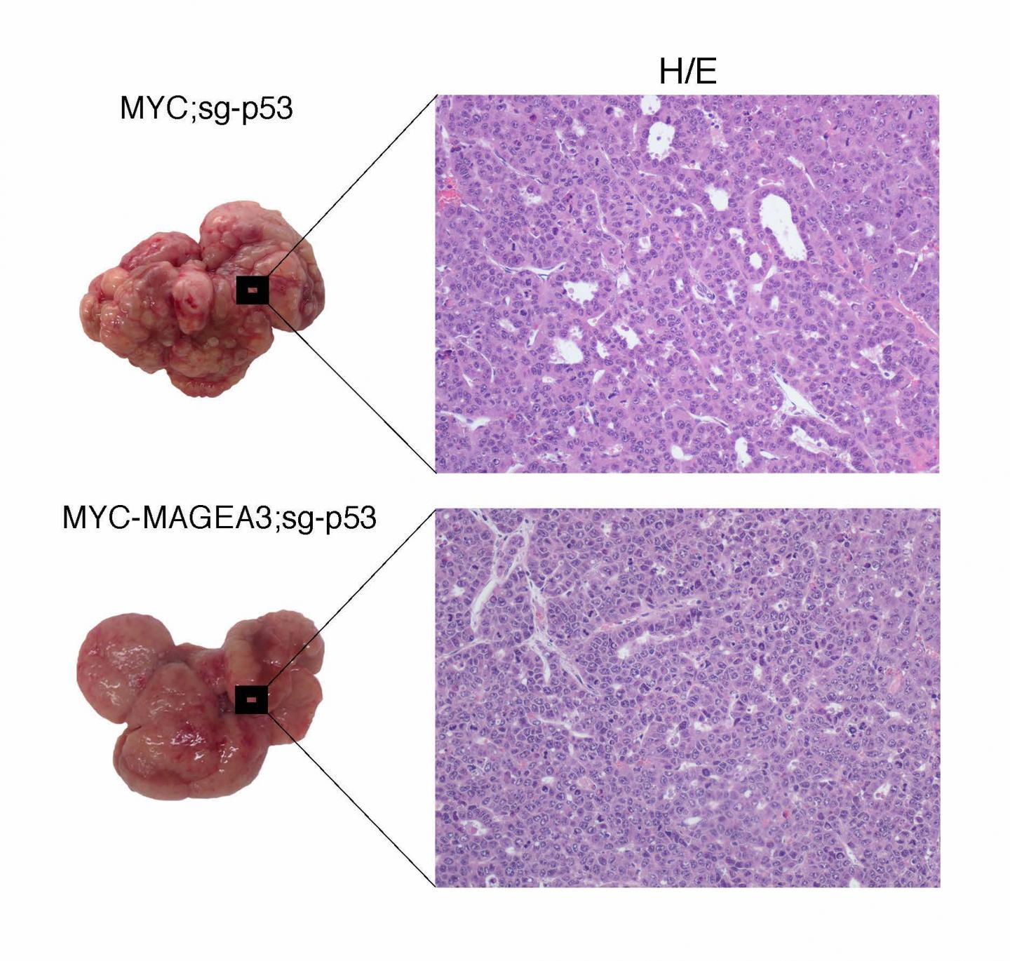 Genetic study of liver cancer reveals new drug target