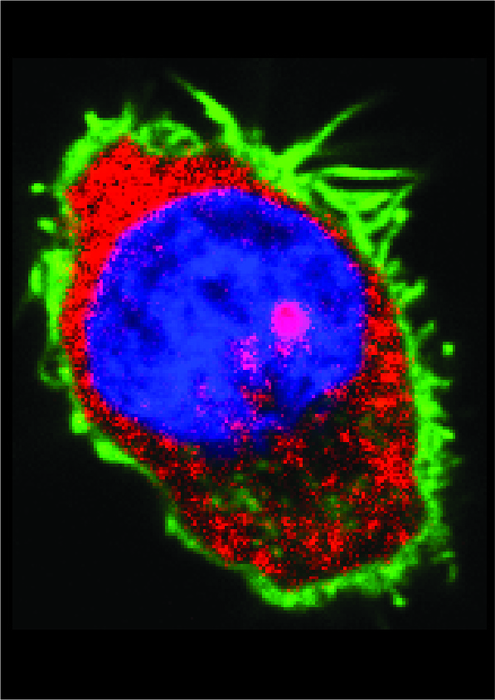 Chemotherapy fails for some blood cancer patients because of crucial gene mutations, finds study by NTU Singapore and Singapore General Hospital