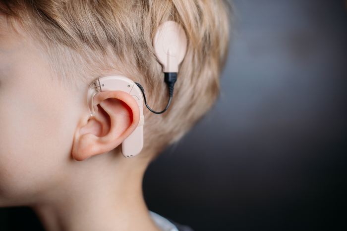 Cochlear implants are more beneficial to deaf children with learning disabilities than hearing aids