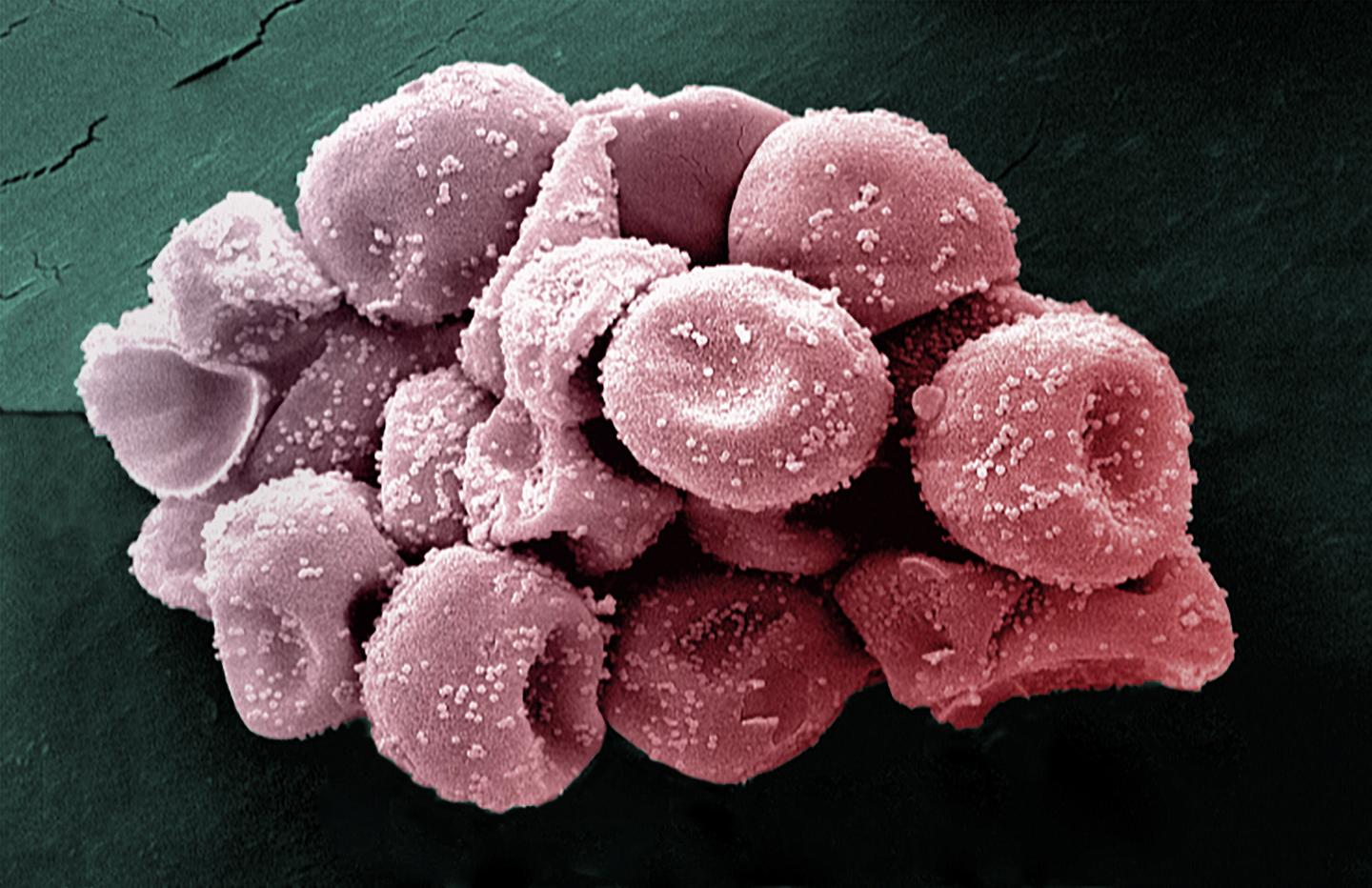 Cypress Pollen Grains Observed in Scanning Electron Microscopy (2200X)