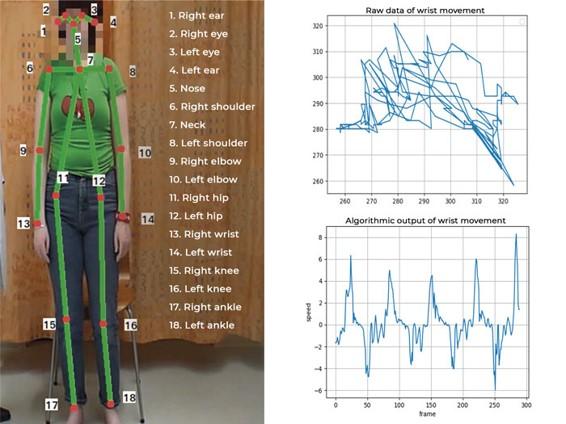 Predefined Keypoints and Raw Data and Algorithmic Output of Wrist Movement