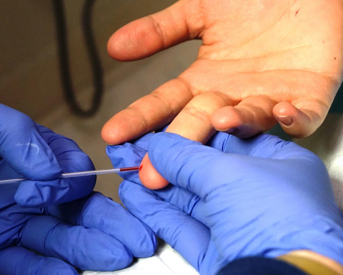 A Novel Finger-Prick Test Can Detect Infection with the Parasite <em>Toxoplasma gondii</em>