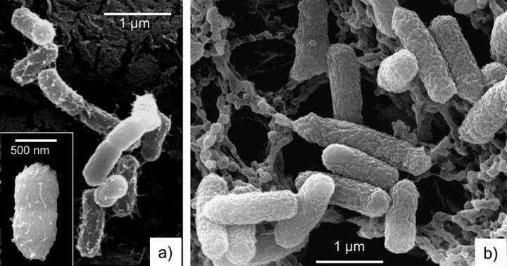<em>E. Coli</em> Healthy and after Treatment with Blue Clay