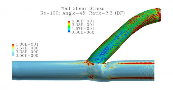 Distributions of Wall Shear Stress at the Conjunction of a Simulated Vein and Graft