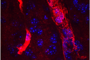 Aquaporin 4 around brain capillaries