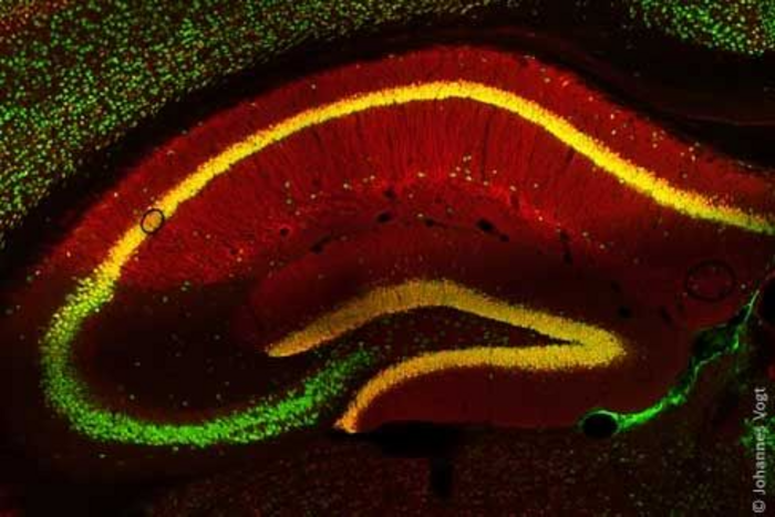 Nerve cells of a mouse brain