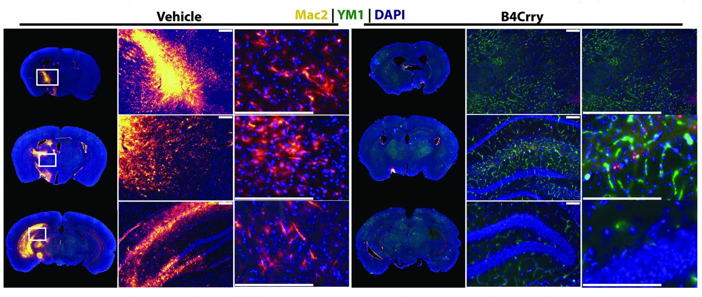 A Strategy to Salvage Stressed Neurons Following Stroke (1 of 2)