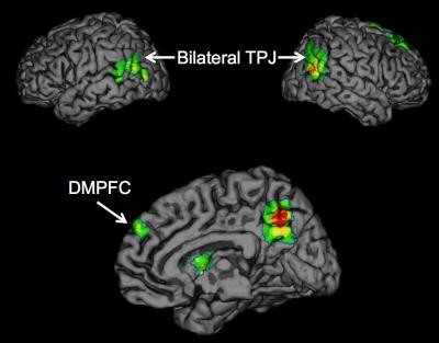 Brain Regions TPJ and DMPFC