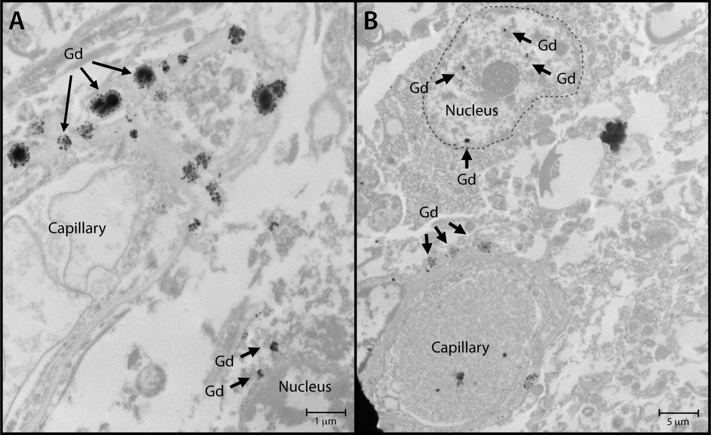 Study Finds No Evidence that Gadolinium Causes Neurologic Harm (3 of 3)