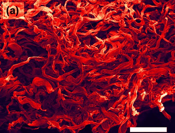Arrangement of Curved Collagen Fibers