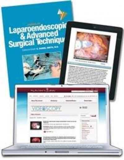<i>Journal of Laparoendoscopic & Advanced Surgical Techniques</i>