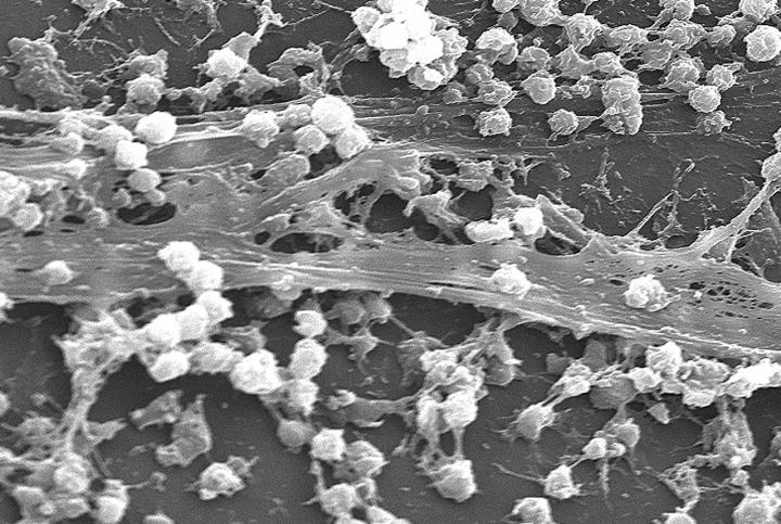 Biofilm Early Detection Findings Will Advance Eurekalert