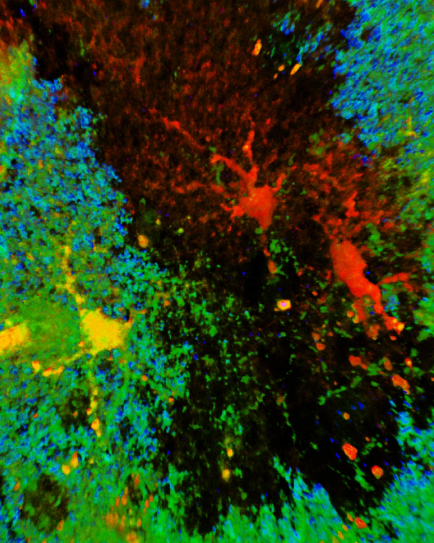 Altered Astrocytes