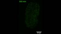 Time-lapse of the outgrowth dynamics of the C. elegans nerve ring