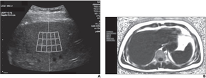 23-Year-Old Man with Body Mass Index of 25.1