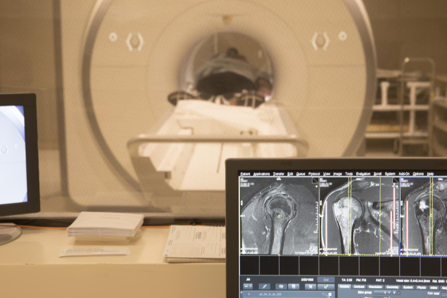 MRI of Participant's Shoulder