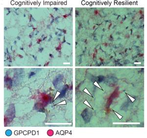 Astrocytes and resilience