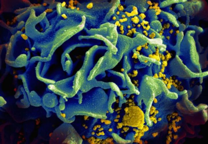 Microscopic Image of an HIV-infected T Cell