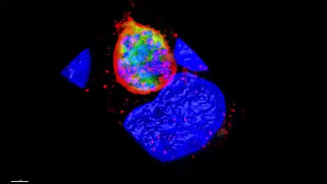 Plasmodium Vacuole