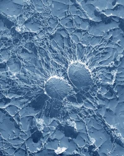 <i>Staphylococcus aureus</i>