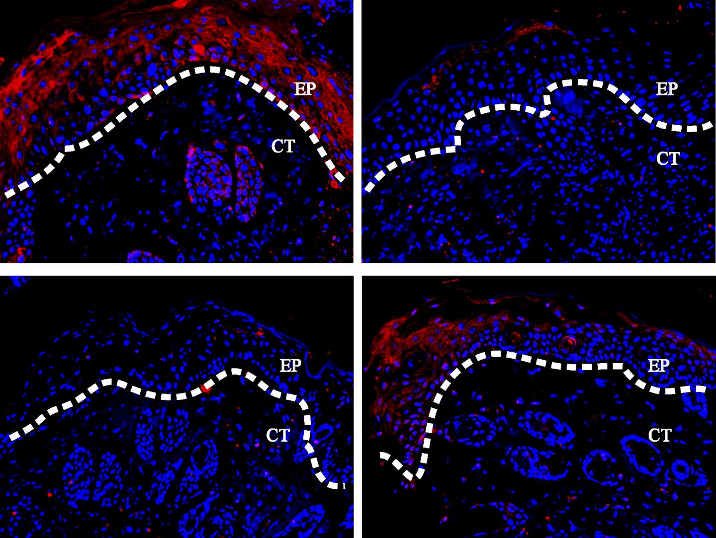 High Sugar Inhibits Wound Healing